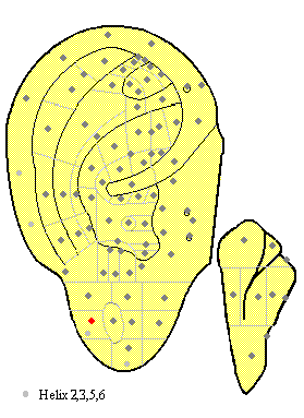 Internal EarMA75